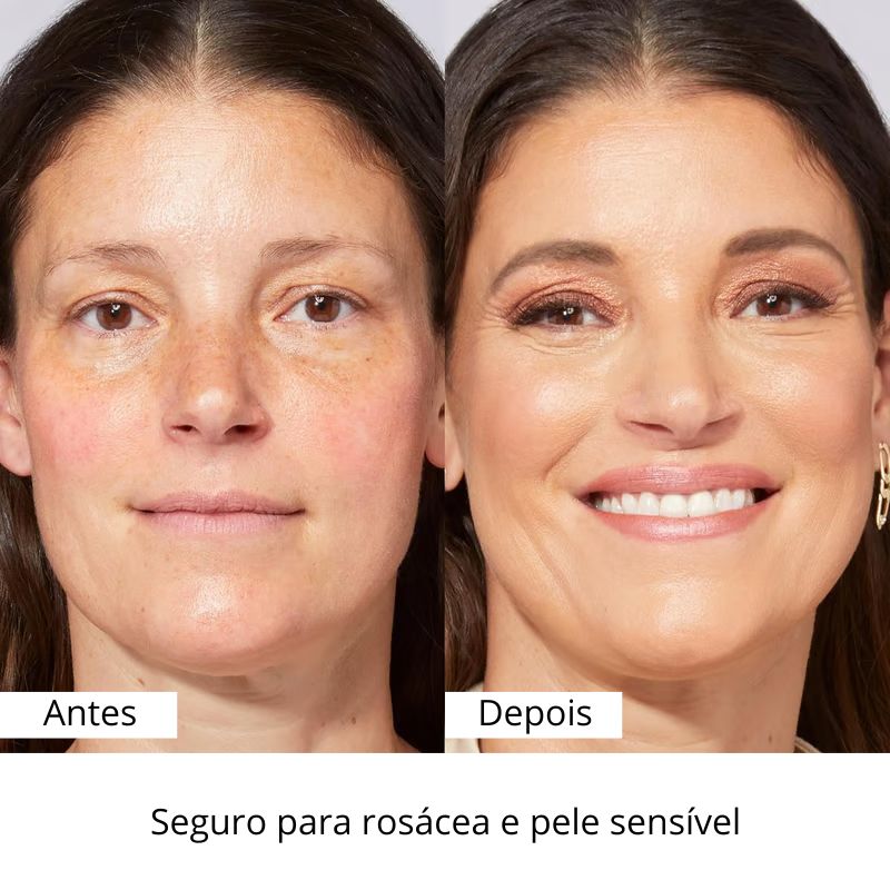 BB Hidratante com SPF 30 – Ilumina, Hidrata e Suaviza a Sua Pele